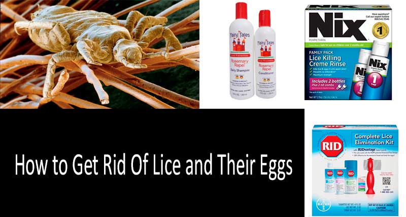 how to get rid of lice