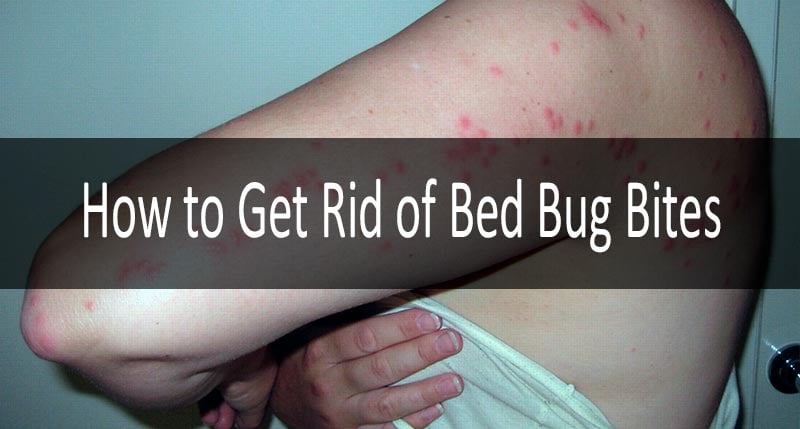 do bedbug bites itch