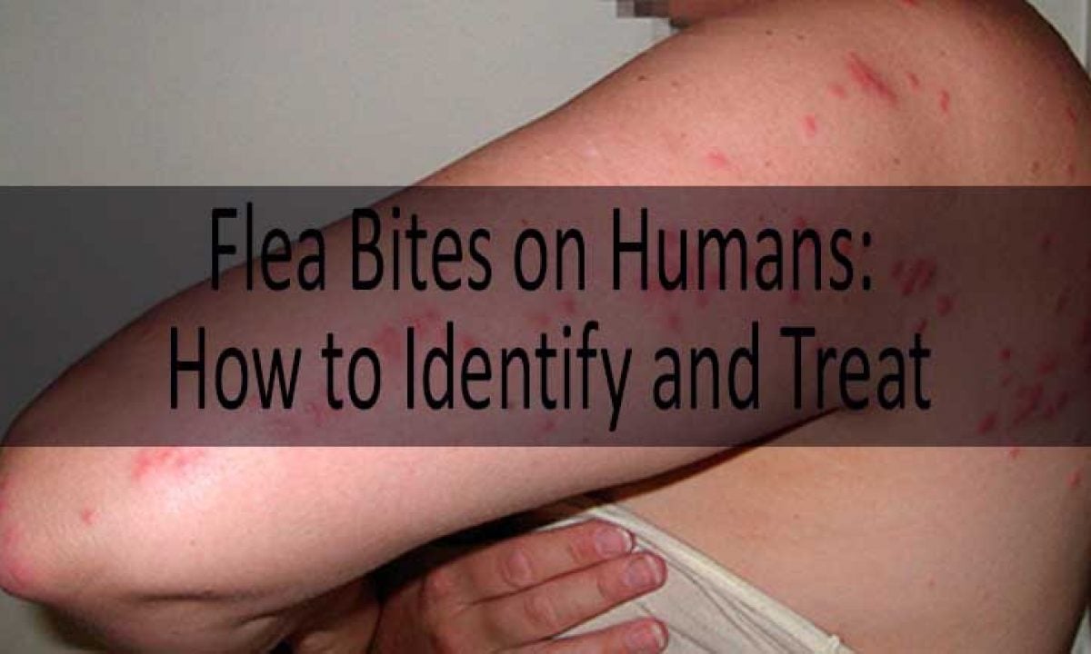what do dog flea bites look like on humans