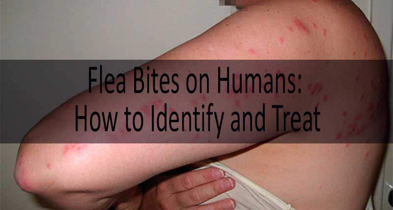 Flea Bite on Human Flea Bites vs Mosquito Bites vs Bed Bug Bites