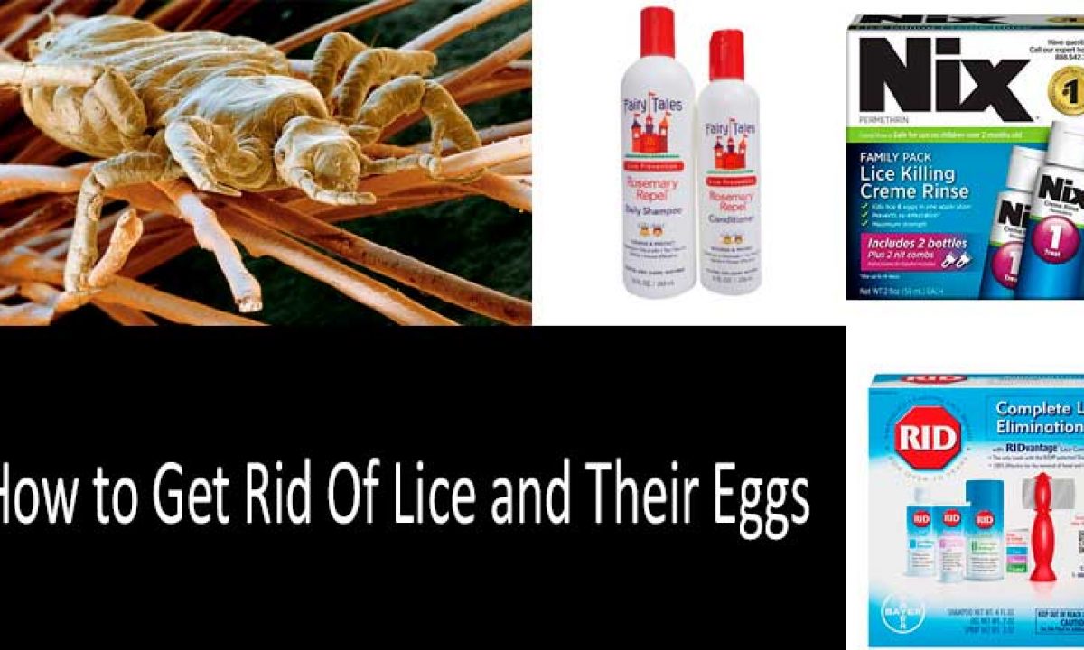 How to Get Rid of Lice: Best Proven Ways and Lice Products in 2022